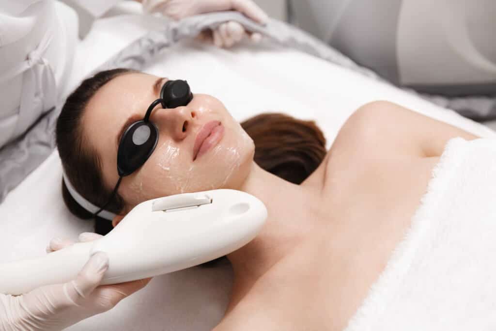 What is a Photofacial and What Can it Do for Me