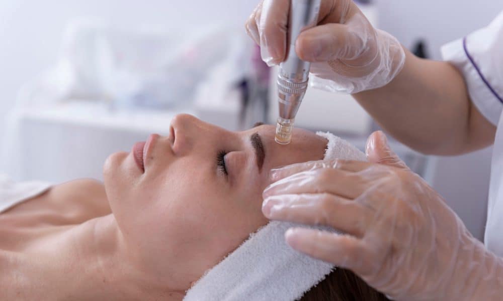 What's the Difference Between a SkinPen and Dermapen Microneedling?