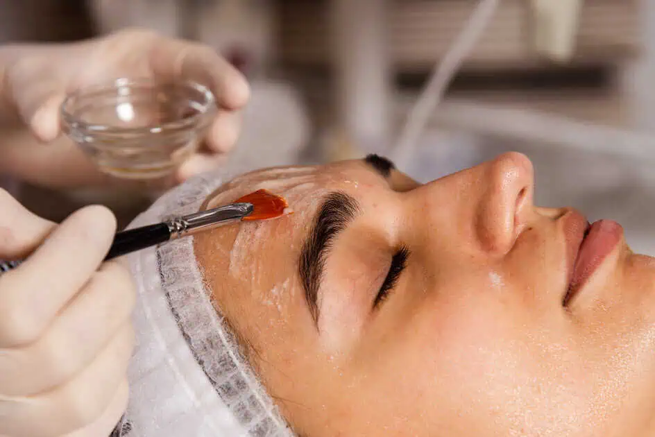 Chemical Peels | Joslin Medical Spa| Georgetown, TX